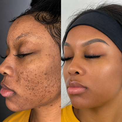Duo Correcteur Éclat