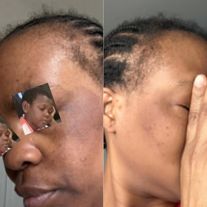 Duo Correcteur Éclat