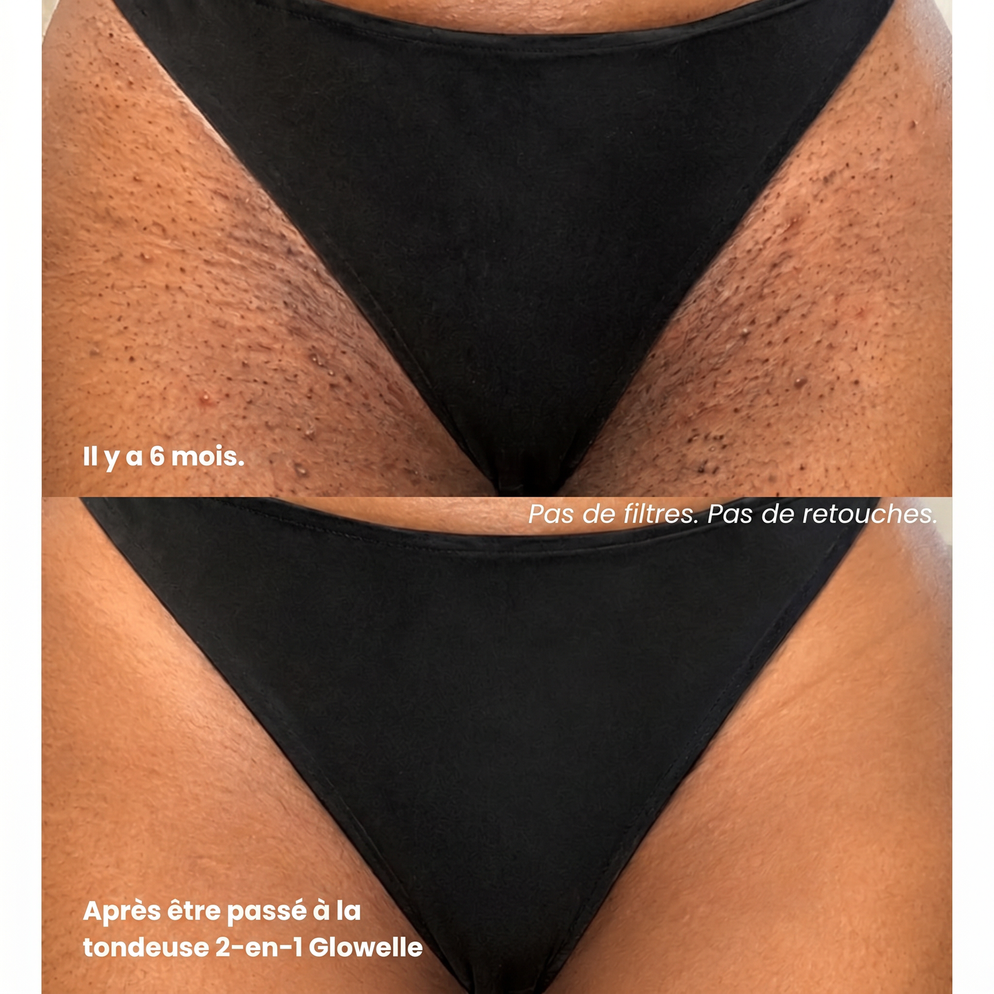 Ebenora™ Anti-Poils Incarnés